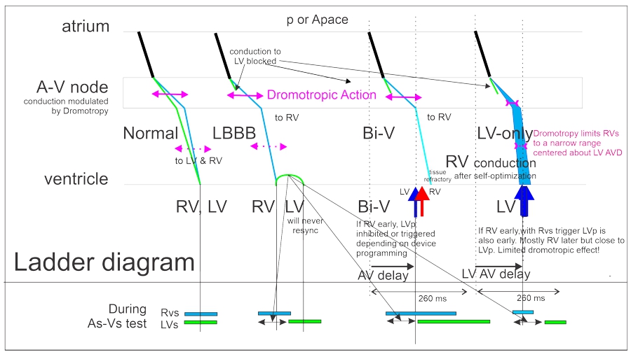 ladder diagram