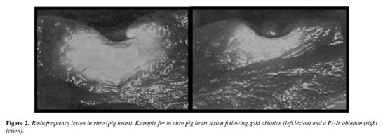 AlCAthGoldPIgHeart
