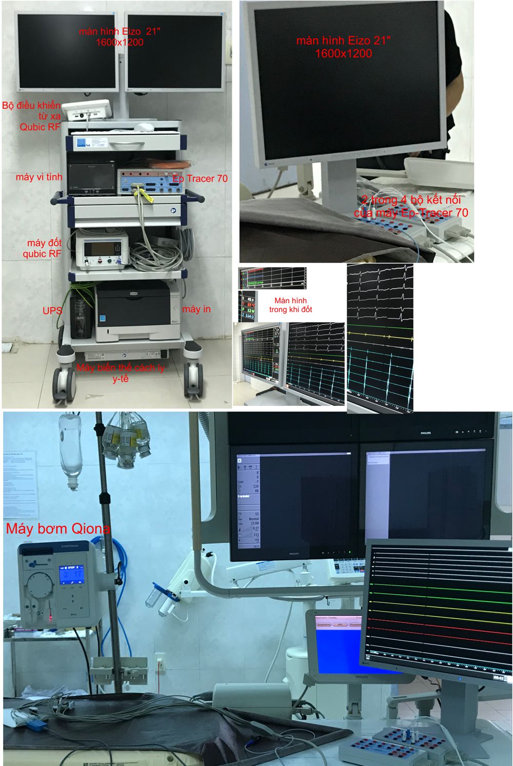 EP System