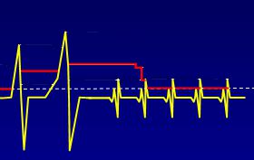 Auto Sensitivity