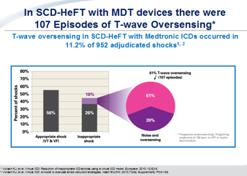 T wave oversensing Medtronic