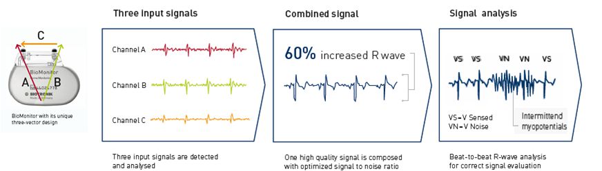 BioMonitor ECG