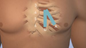 BioMonitor Position
