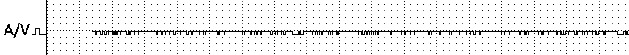 Signal unipolar