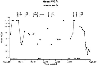 PVC Rate