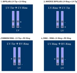 Electronic Repositioning
