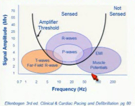Cardiac Frequency