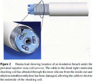 Durata Shock coil short