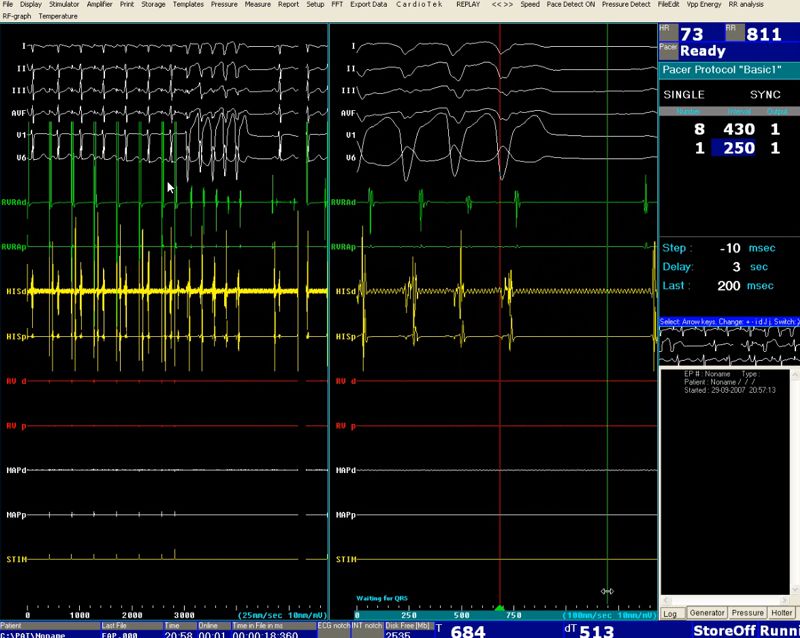 Ep-Tracer Induction