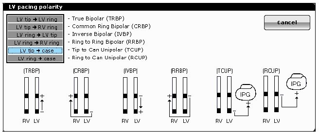 LV Pacing Evia HF-T