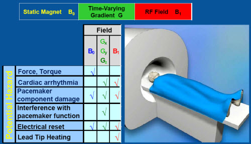 MRI effect