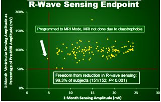 Biotronik Iforia MRI study. V threshold