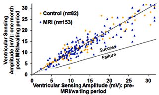 HRS 2015 Evera MRI study. V threshold