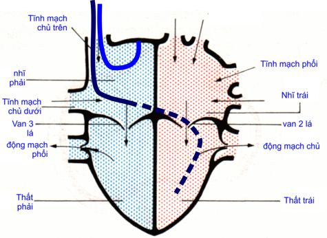 NCRT2