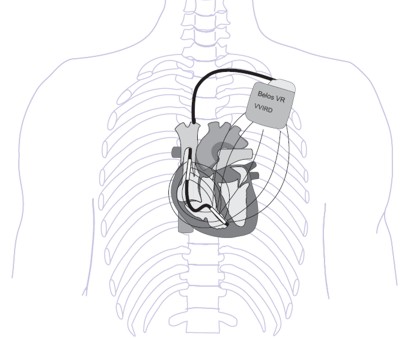 ICDSystem