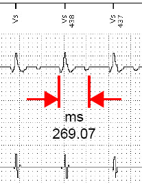 ICS measurement