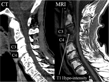 MRI1