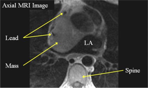 MRI2