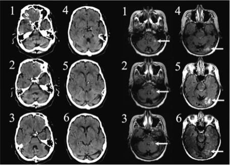MRI3