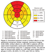 thoracic ảtifact