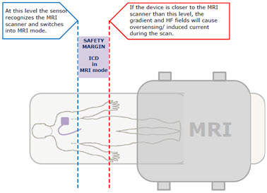 MRI AutoDetect