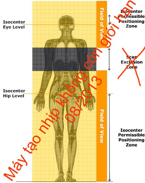 No MRI restriction