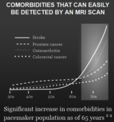 MRI