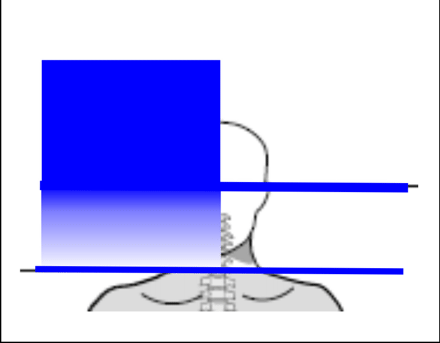 Giới hạn dy MRI St Jude