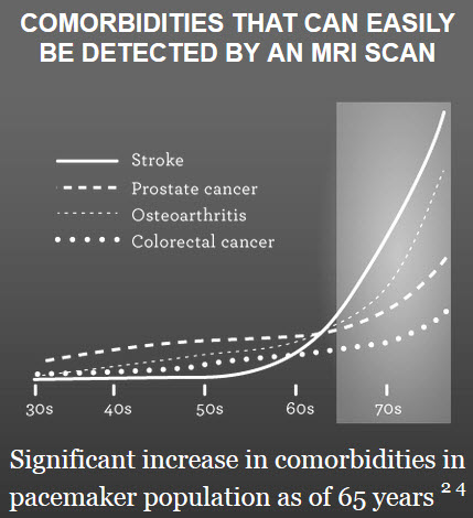 MRI needs