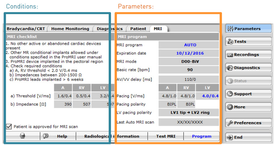 MRI Prog A