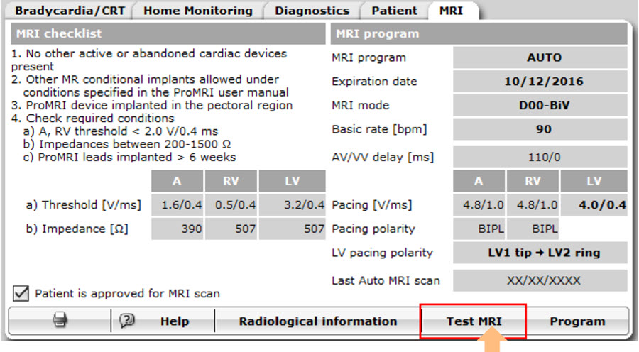 MRI Prog B