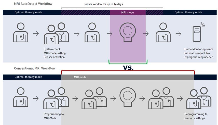 MRI AutoDetect