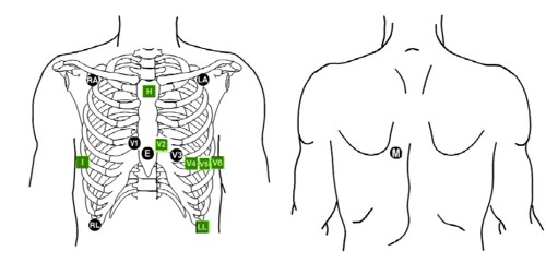 ElectrodePlacement\