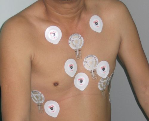 MTWAElectrodes
