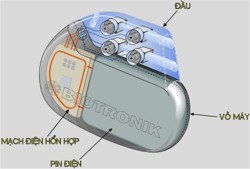 Pacemaker