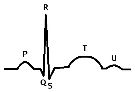 QRS