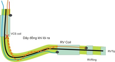 Riata diagram