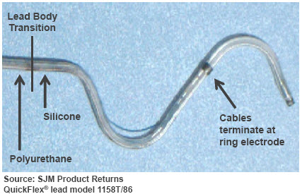 QuickFlex