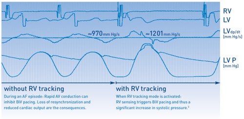 StratosRVTracking