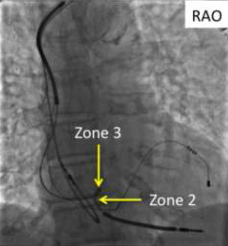 x ray Durrata