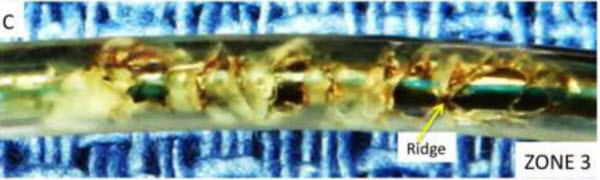Durata failure