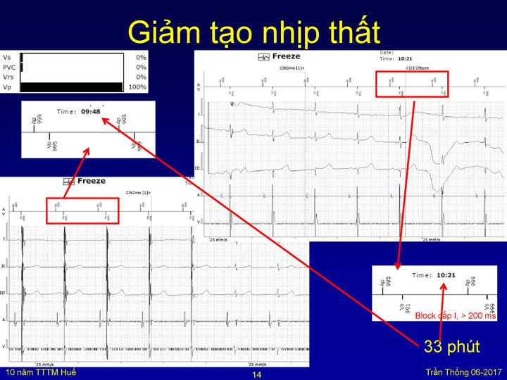 Slide 14