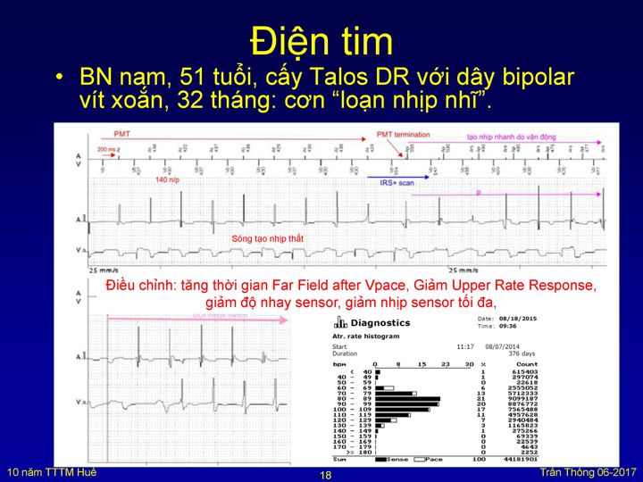 Slide 19