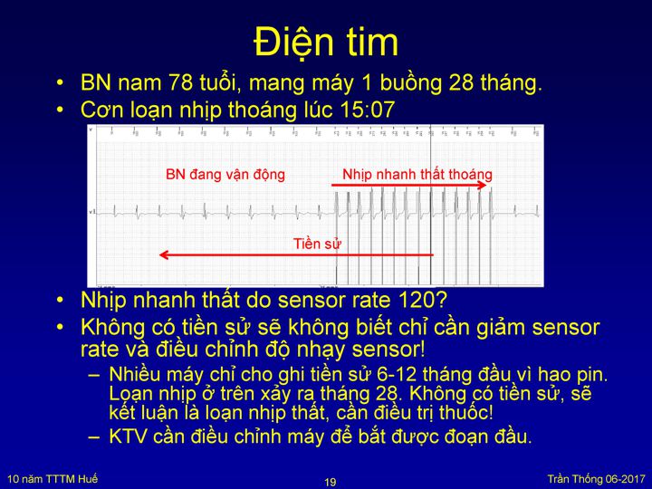 Slide 20