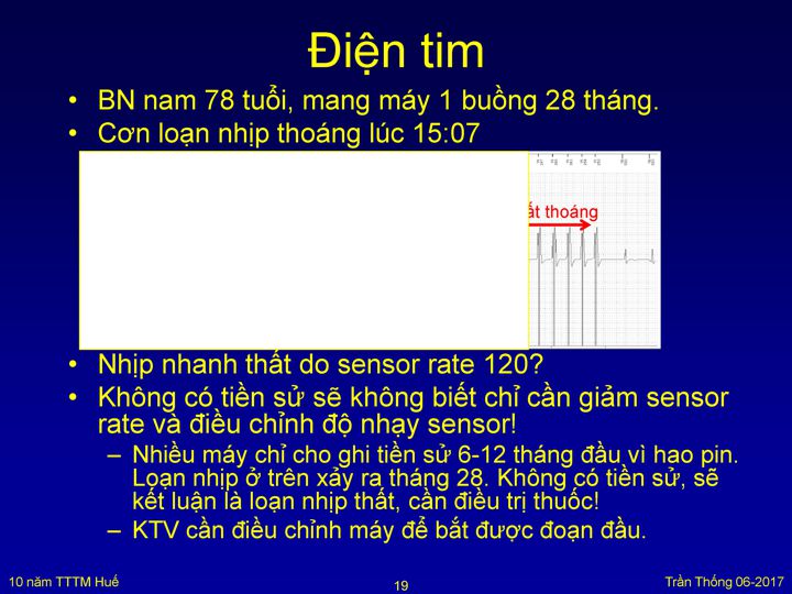 Slide 21