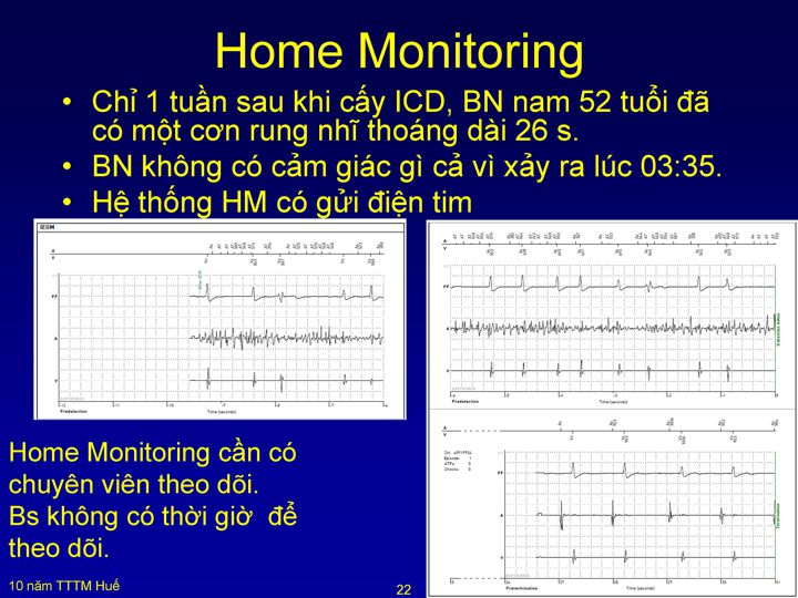 Slide 24