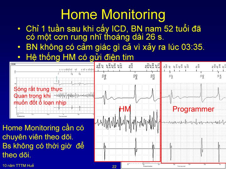 Slide 25