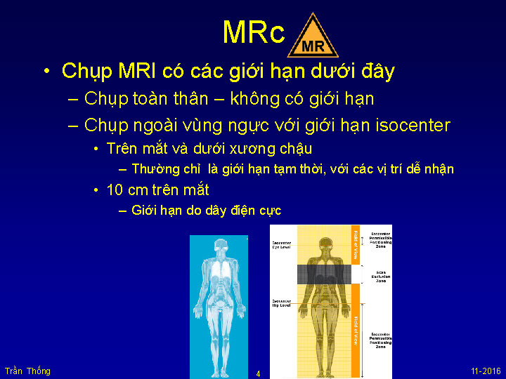 VNHRS2016 Chup MRI