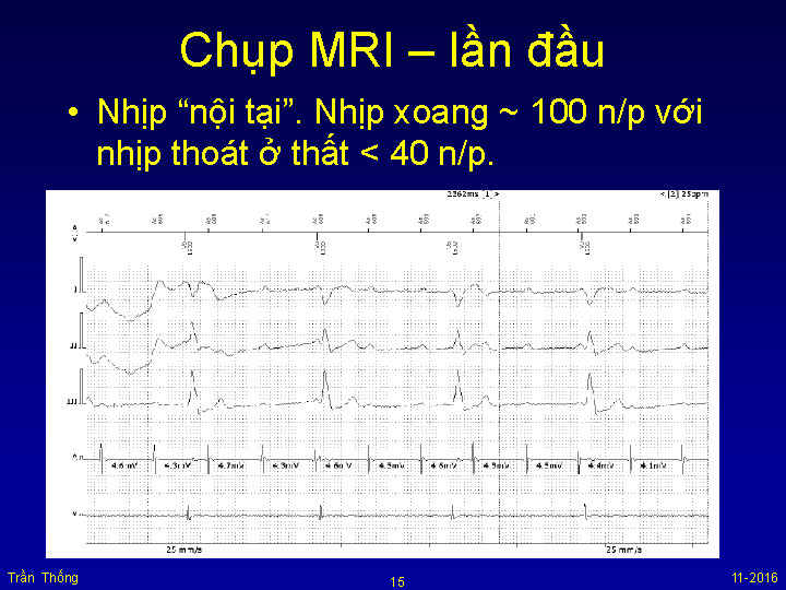 VNHRS2016 Chup MRI