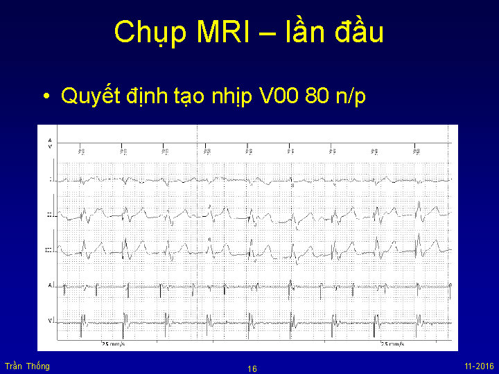 VNHRS2016 Chup MRI